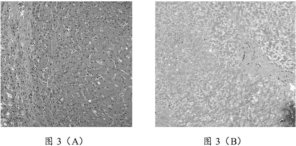 Composition and application thereof