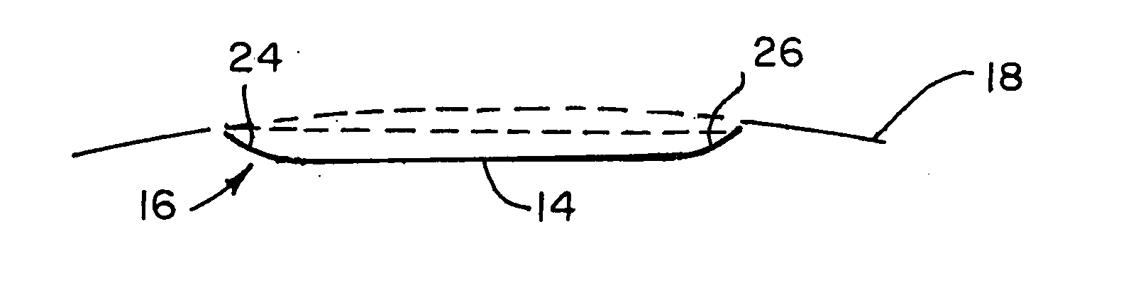 Dimples comprised of two or more intersecting surfaces