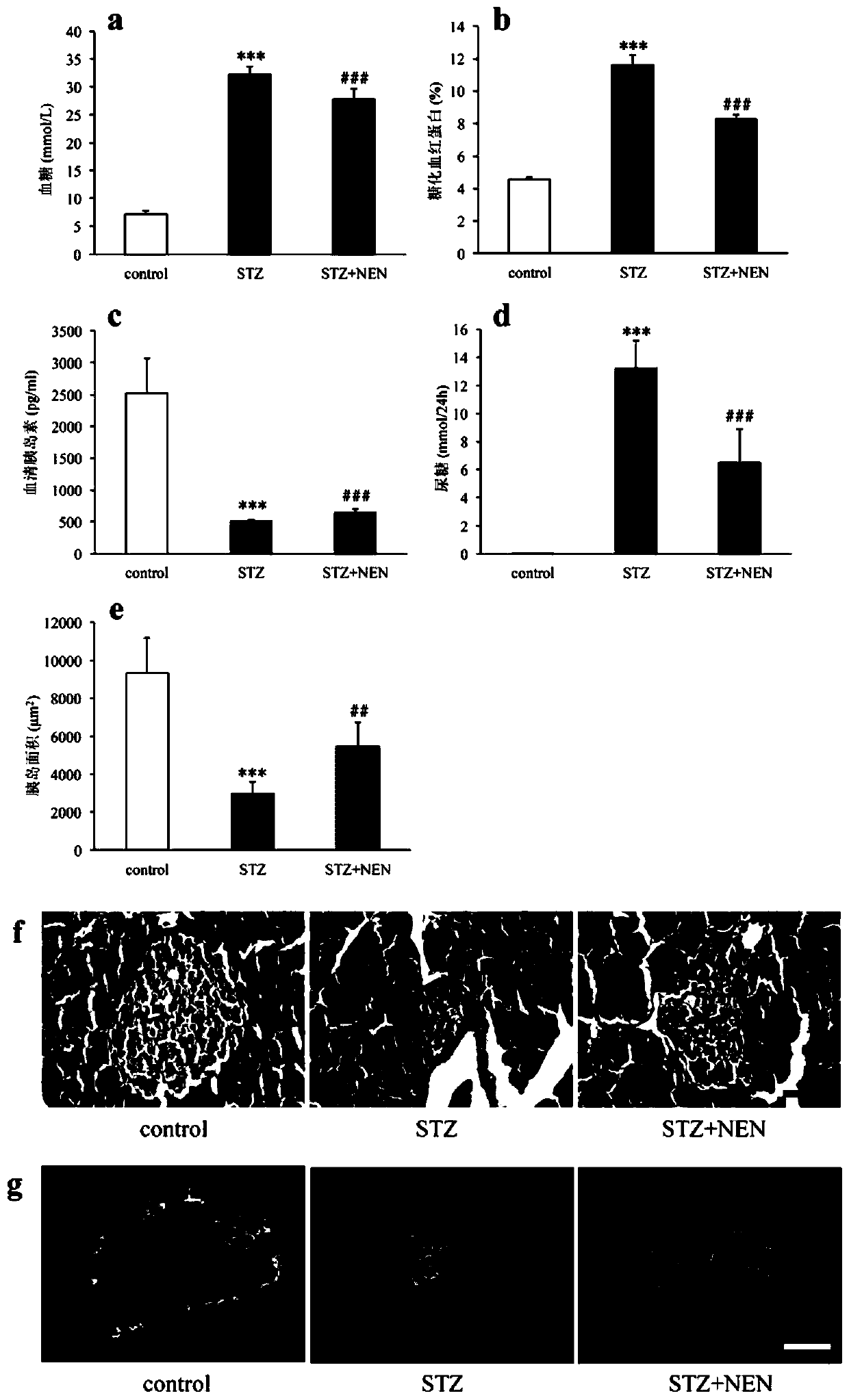 Application of niclosamide ethanolamine salt in preparation of type 1 diabetes medicine