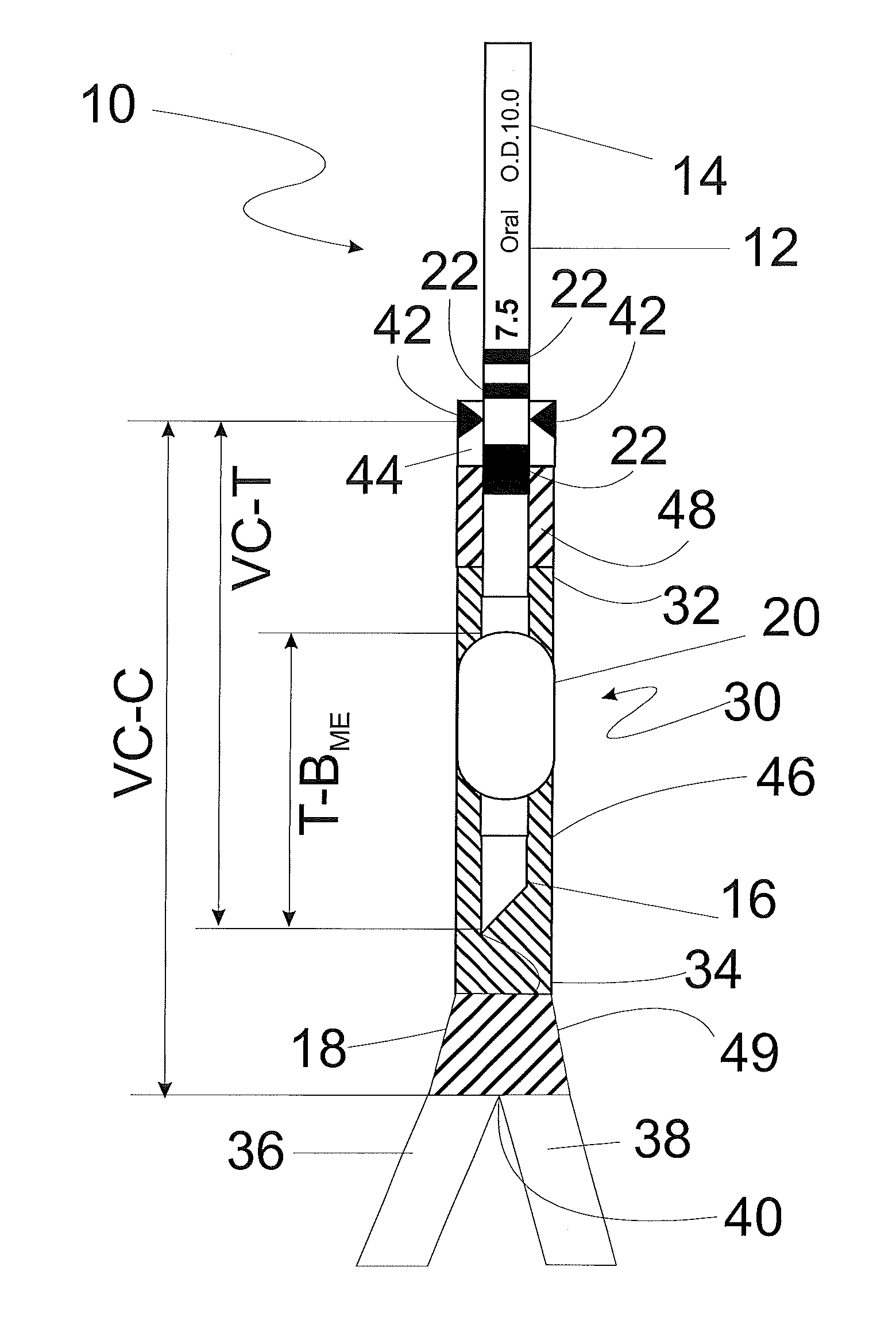 Method and apparatus for determining optimal endotracheal tube size