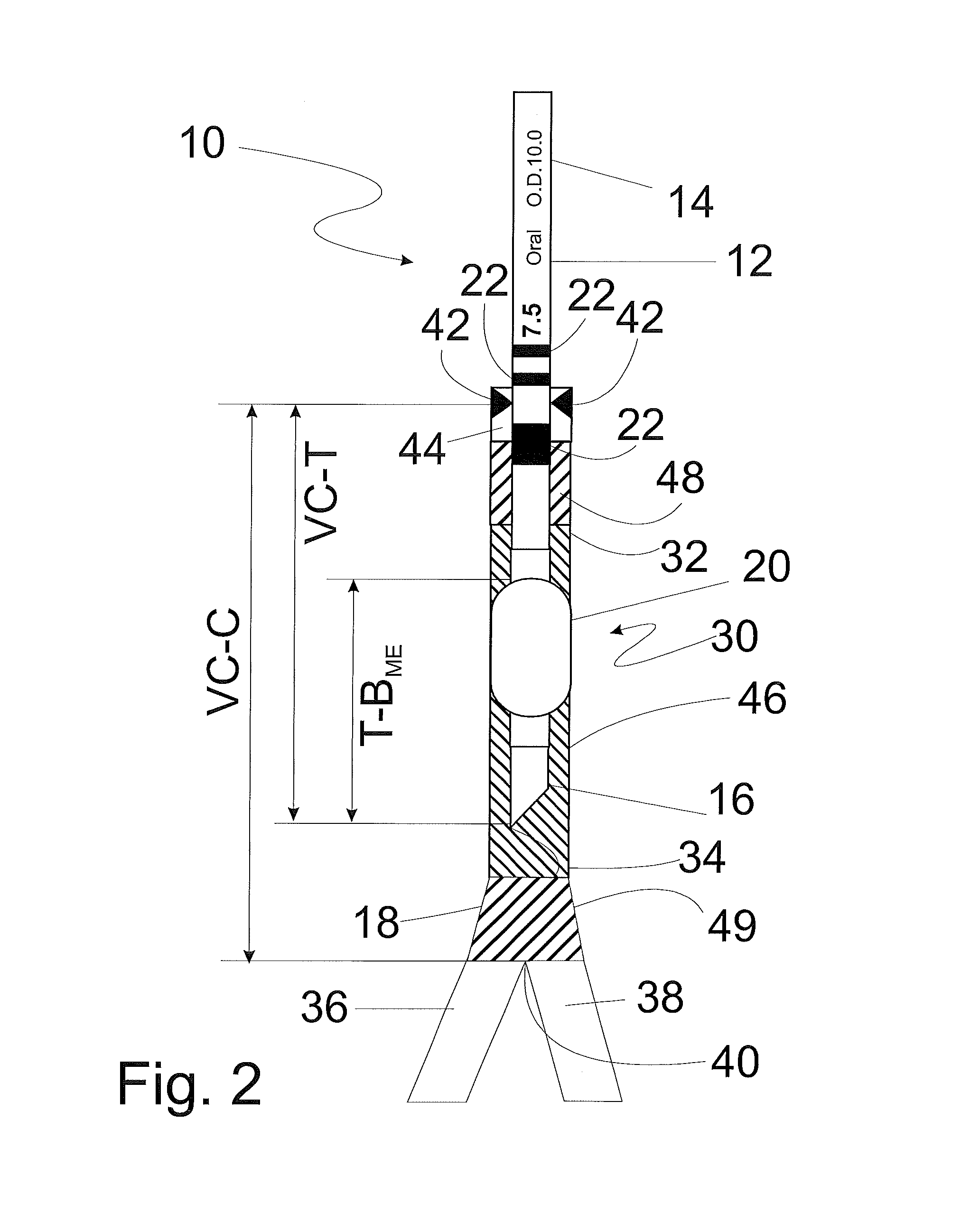 Method and apparatus for determining optimal endotracheal tube size