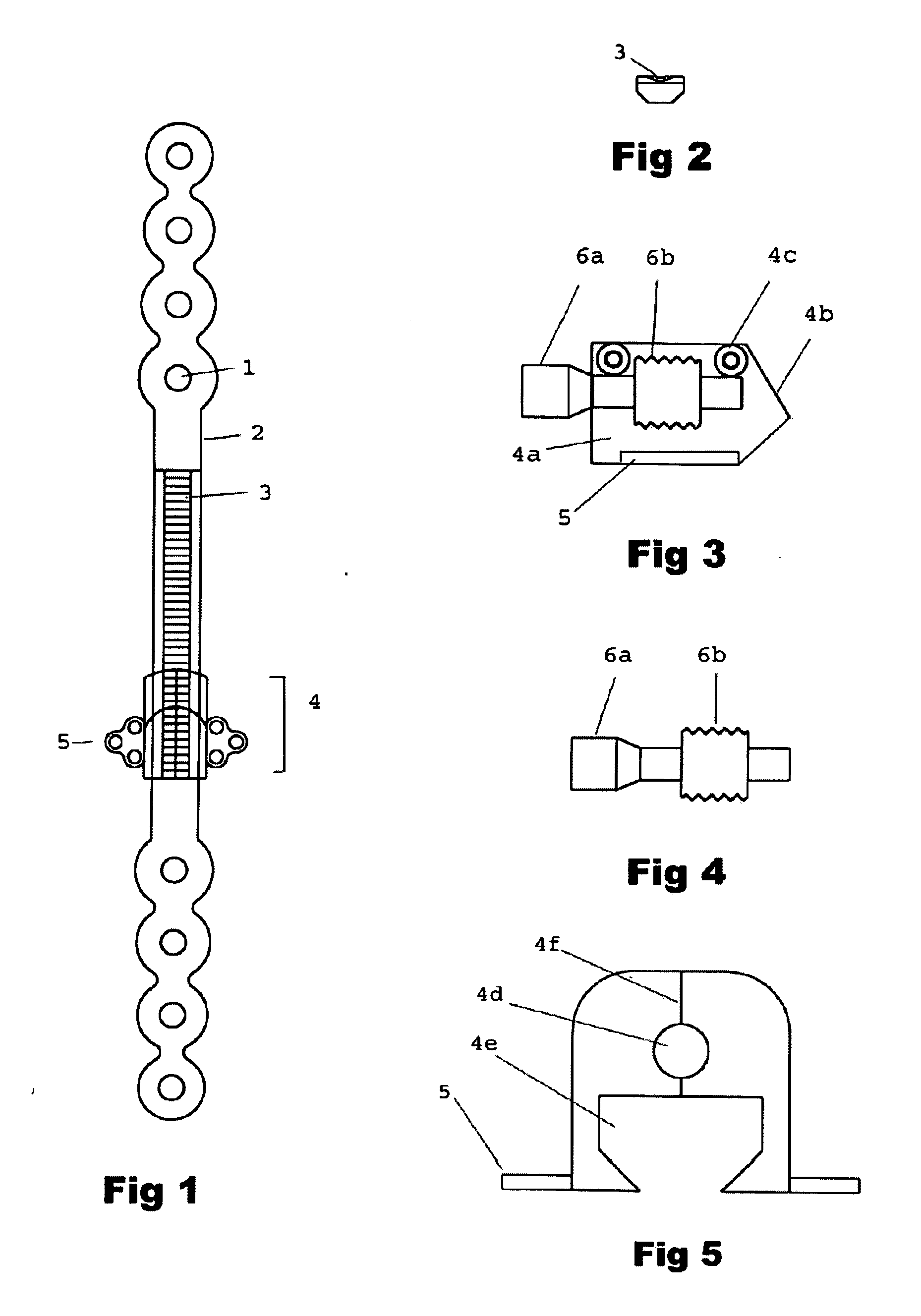 Mandibular bone transport reconstruction plate