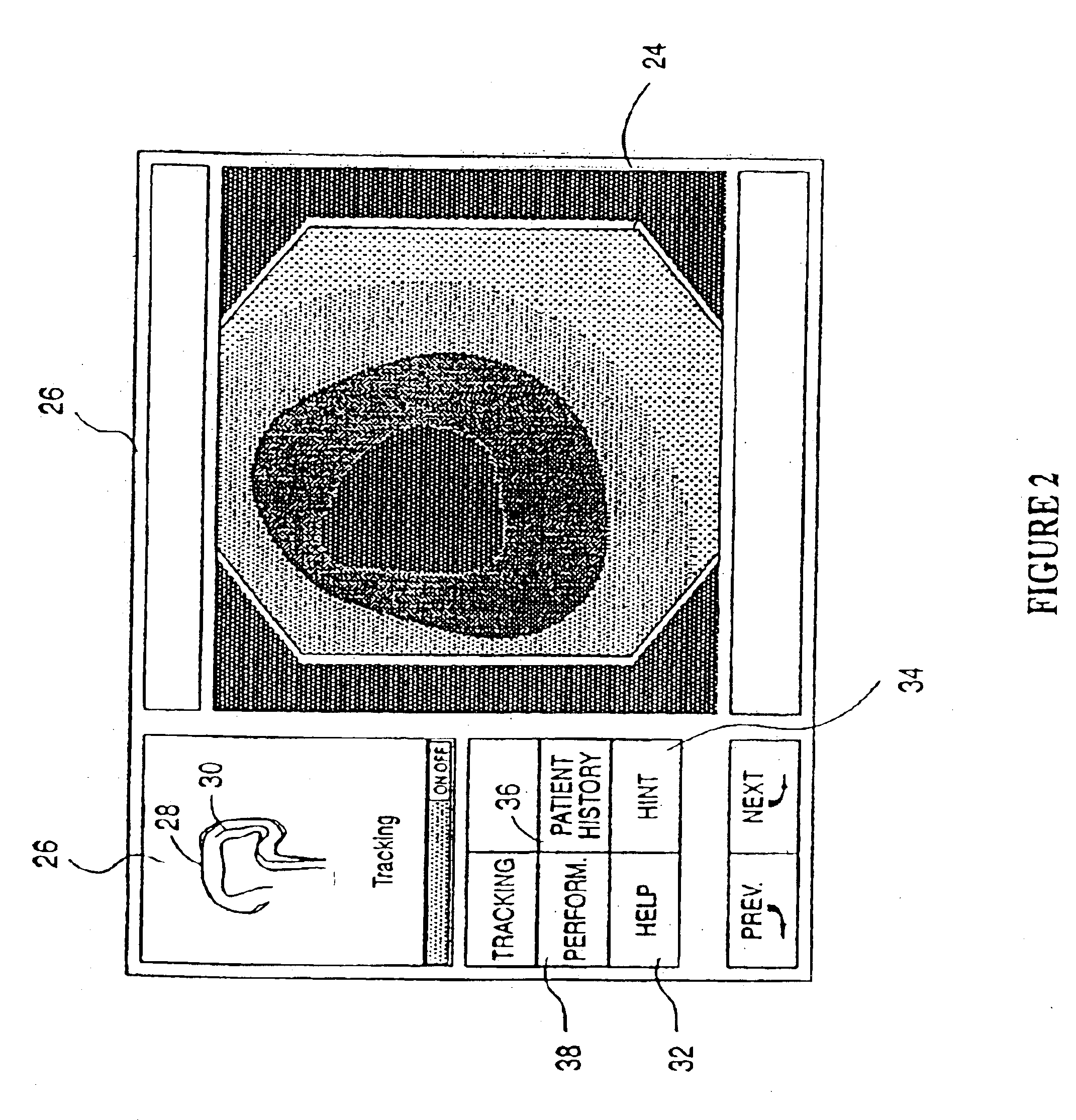 Endoscopic tutorial system