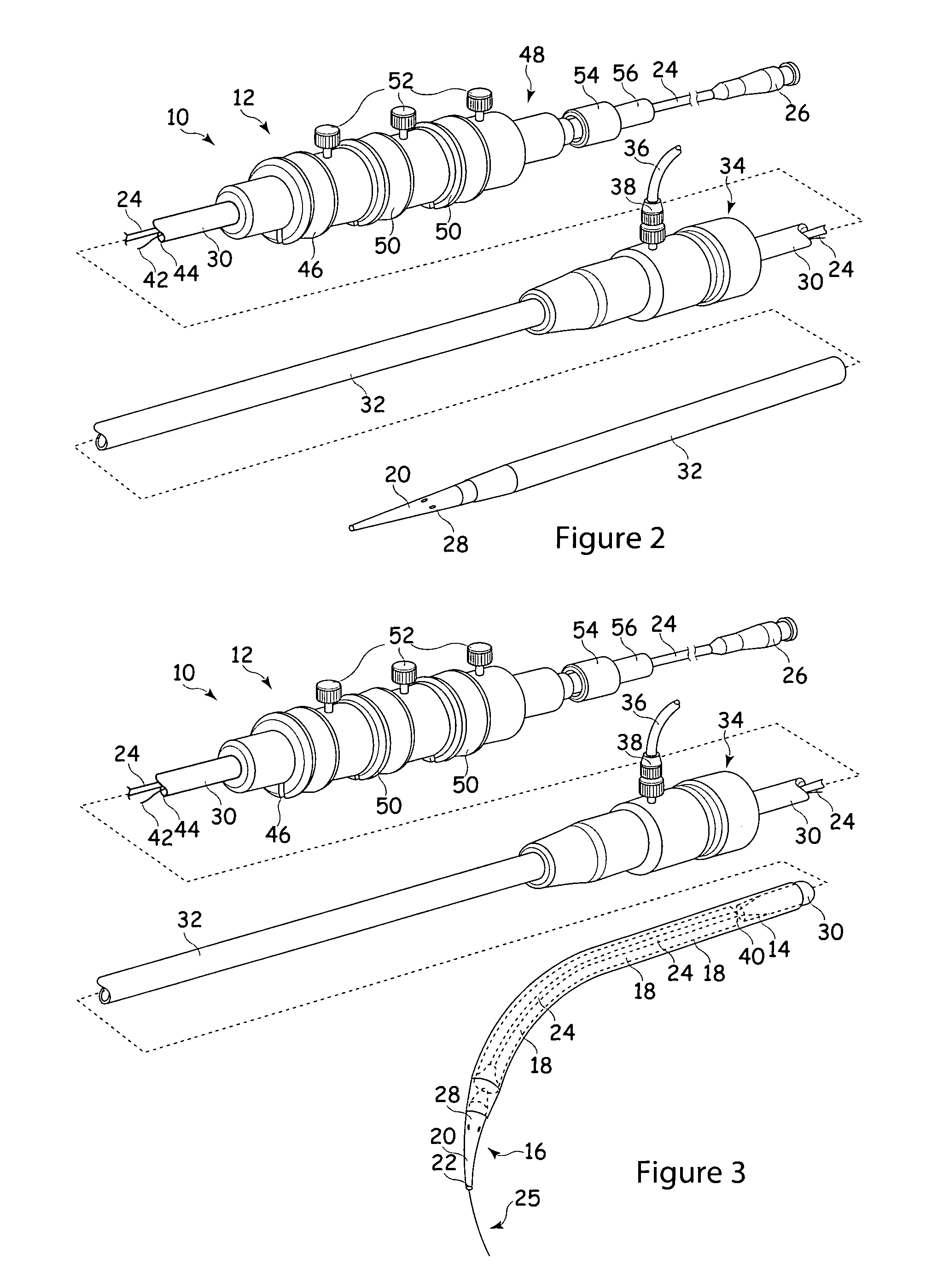 Apparatus for and method of fitting a stent-graft or similar device