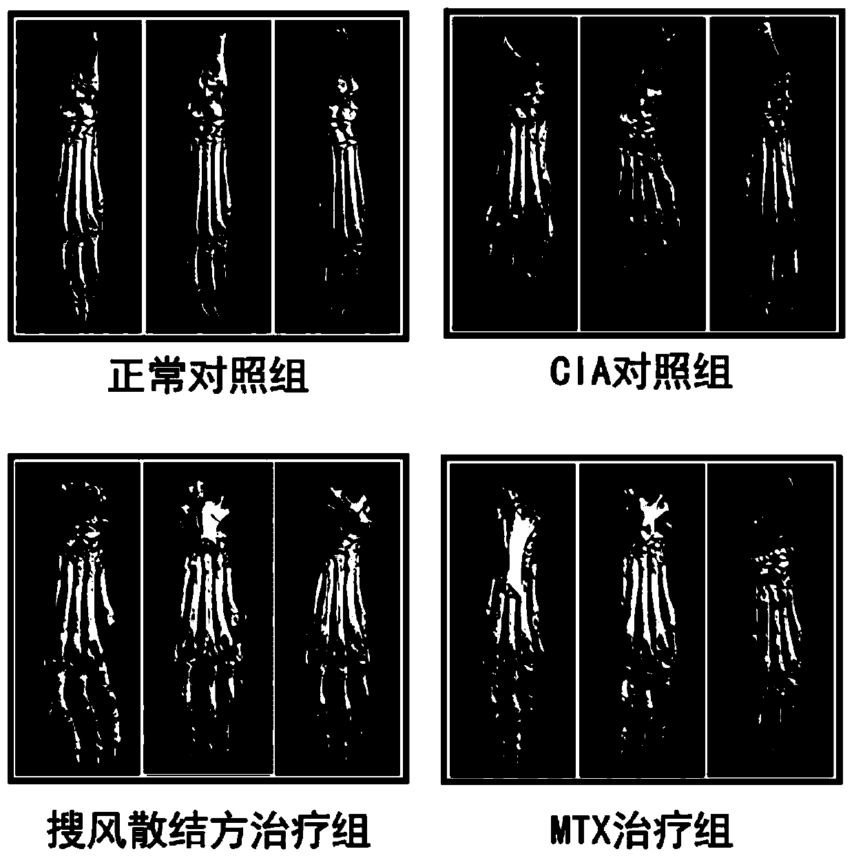 Wind-dispelling stagnation-eliminating traditional Chinese medicine composition and application thereof