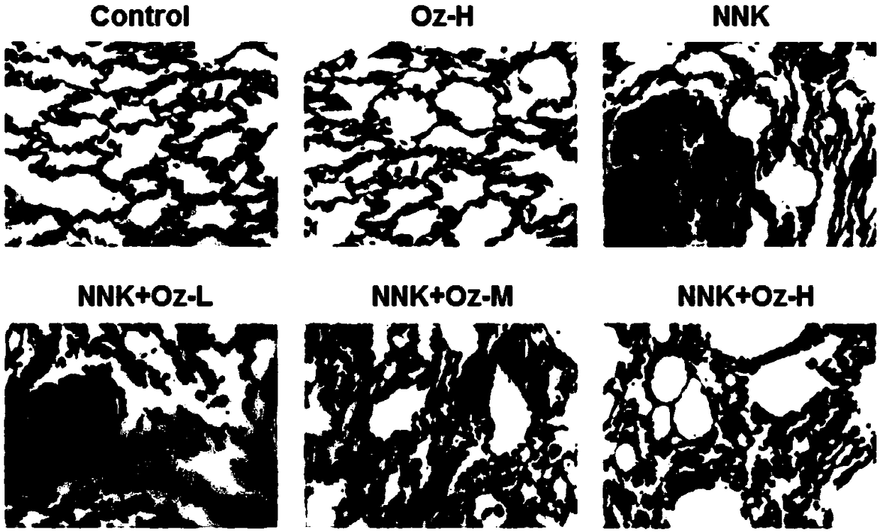 Application of thromboxane A2 synthetase inhibitor ozagrel in preparing drug for treating smoking-induced lung cancer