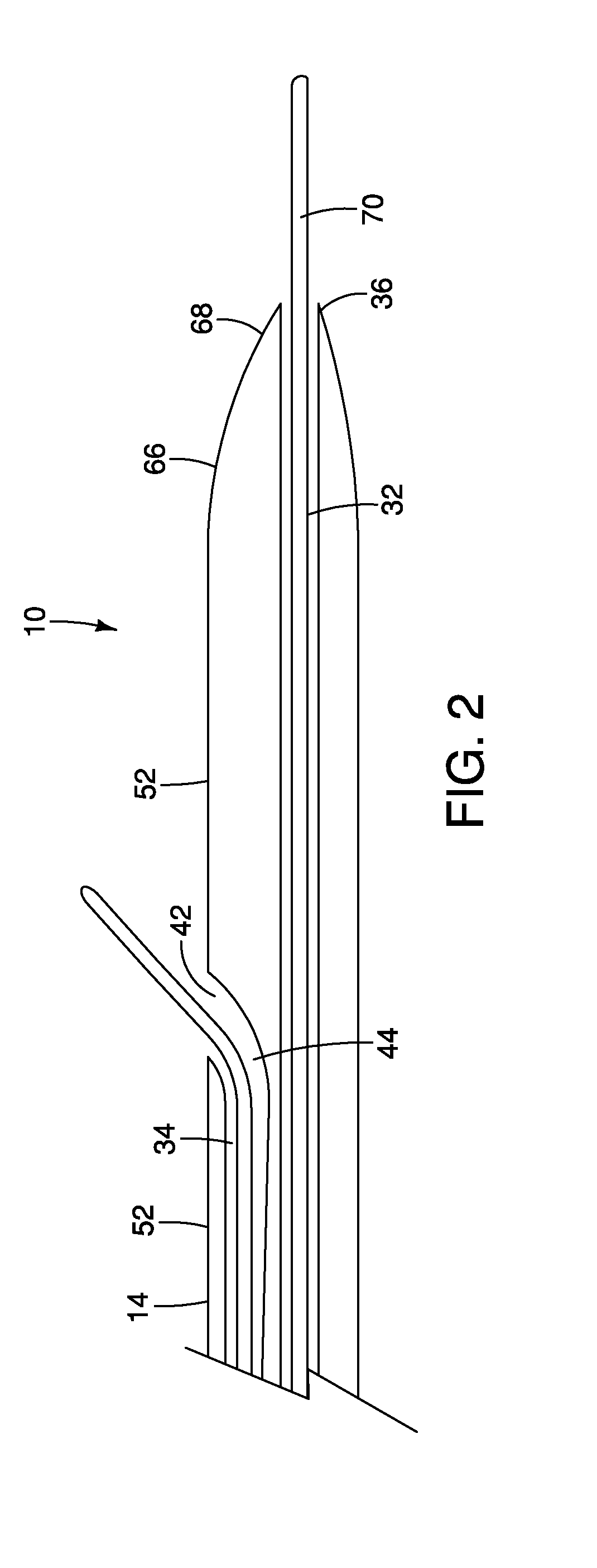 Biliary System Catheter