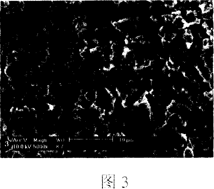 Injection type tissue engineering bone renovation material and construct method thereof