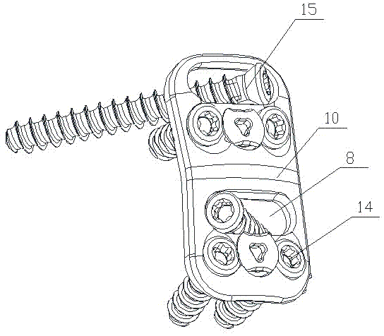 Steel plate for anterior cervial internal fixation and guiding device