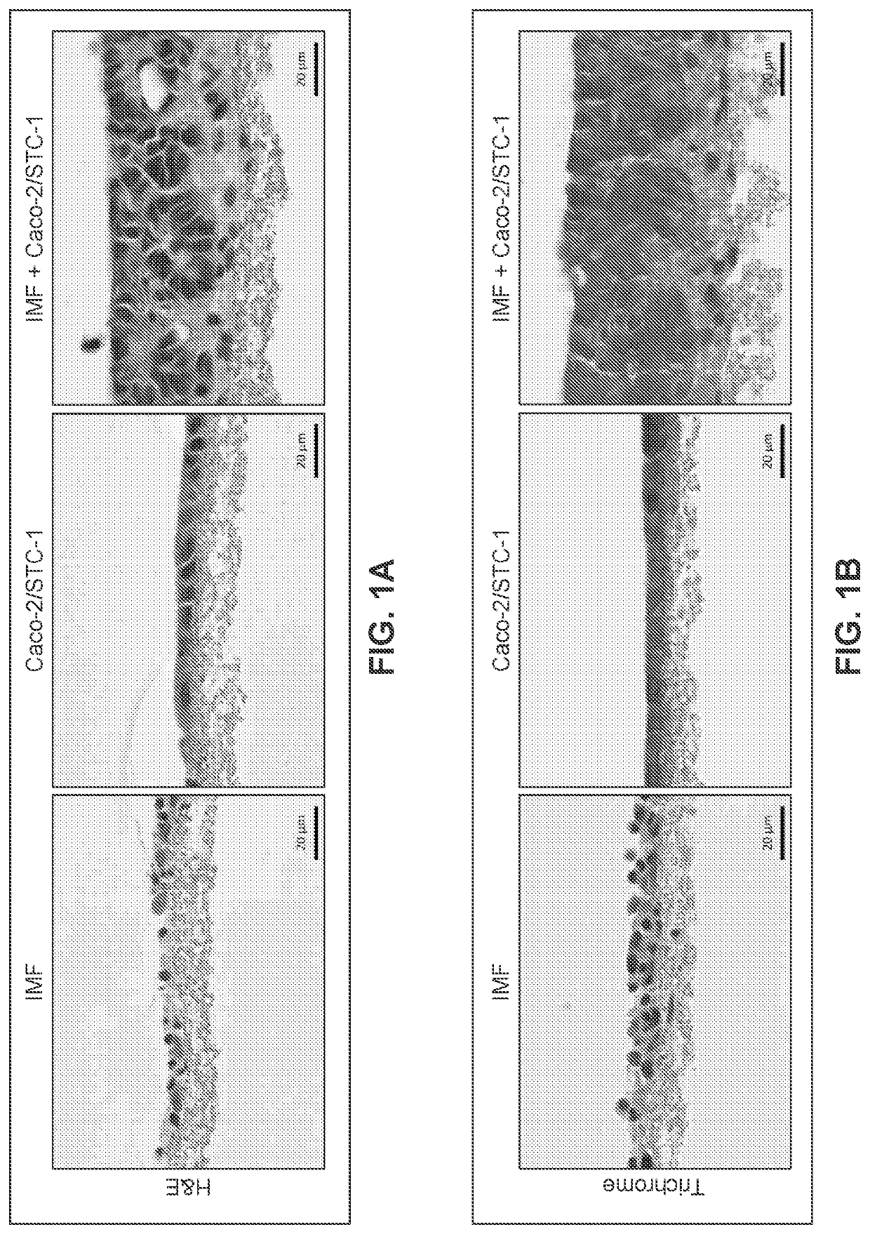 Engineered Intestinal Tissue and Uses Thereof