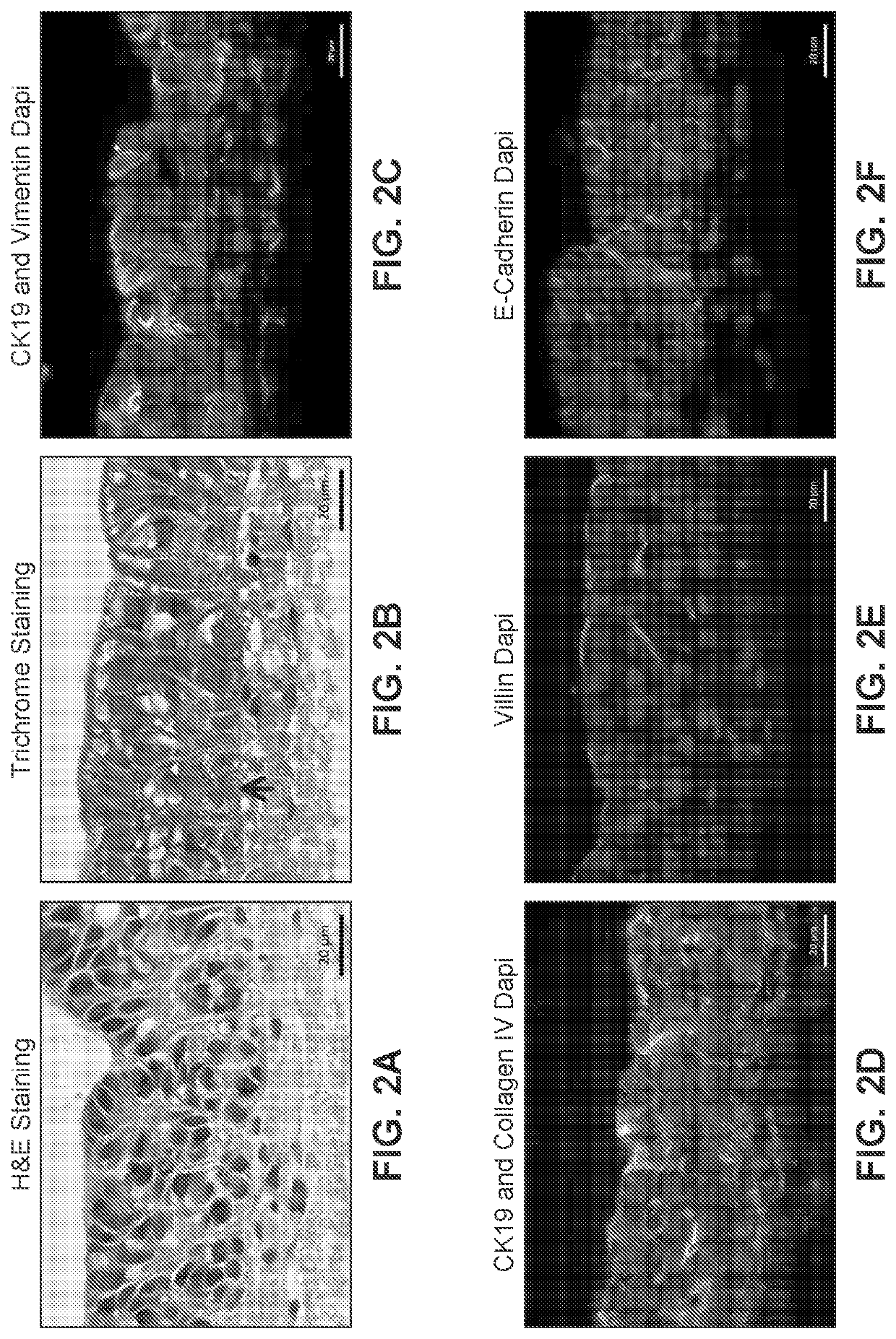 Engineered Intestinal Tissue and Uses Thereof