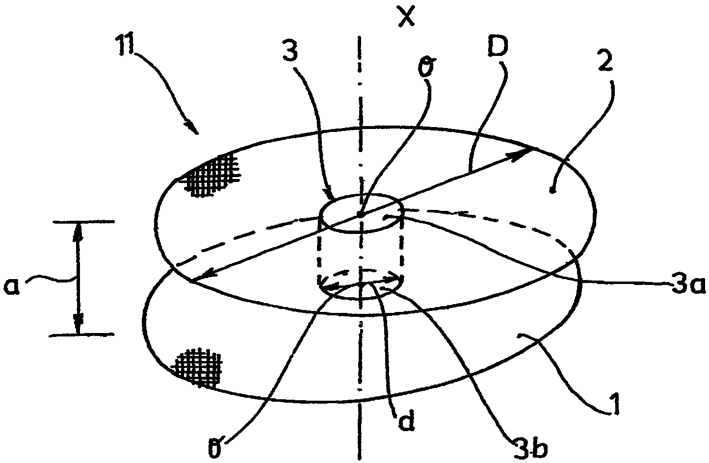 Medical device for the reconstruction of parastomal hernias and/or for the prevention of their development