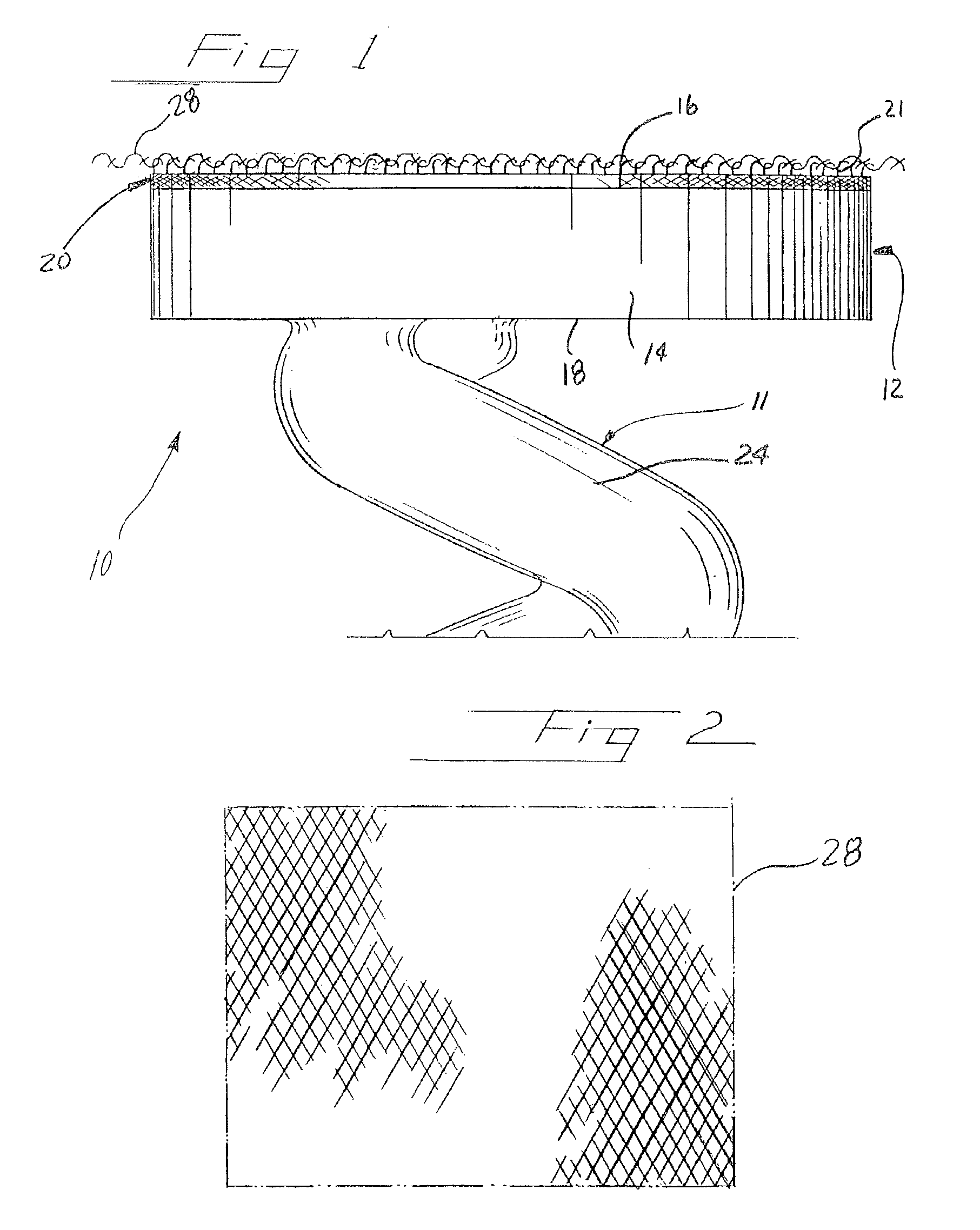 Hernia repair method