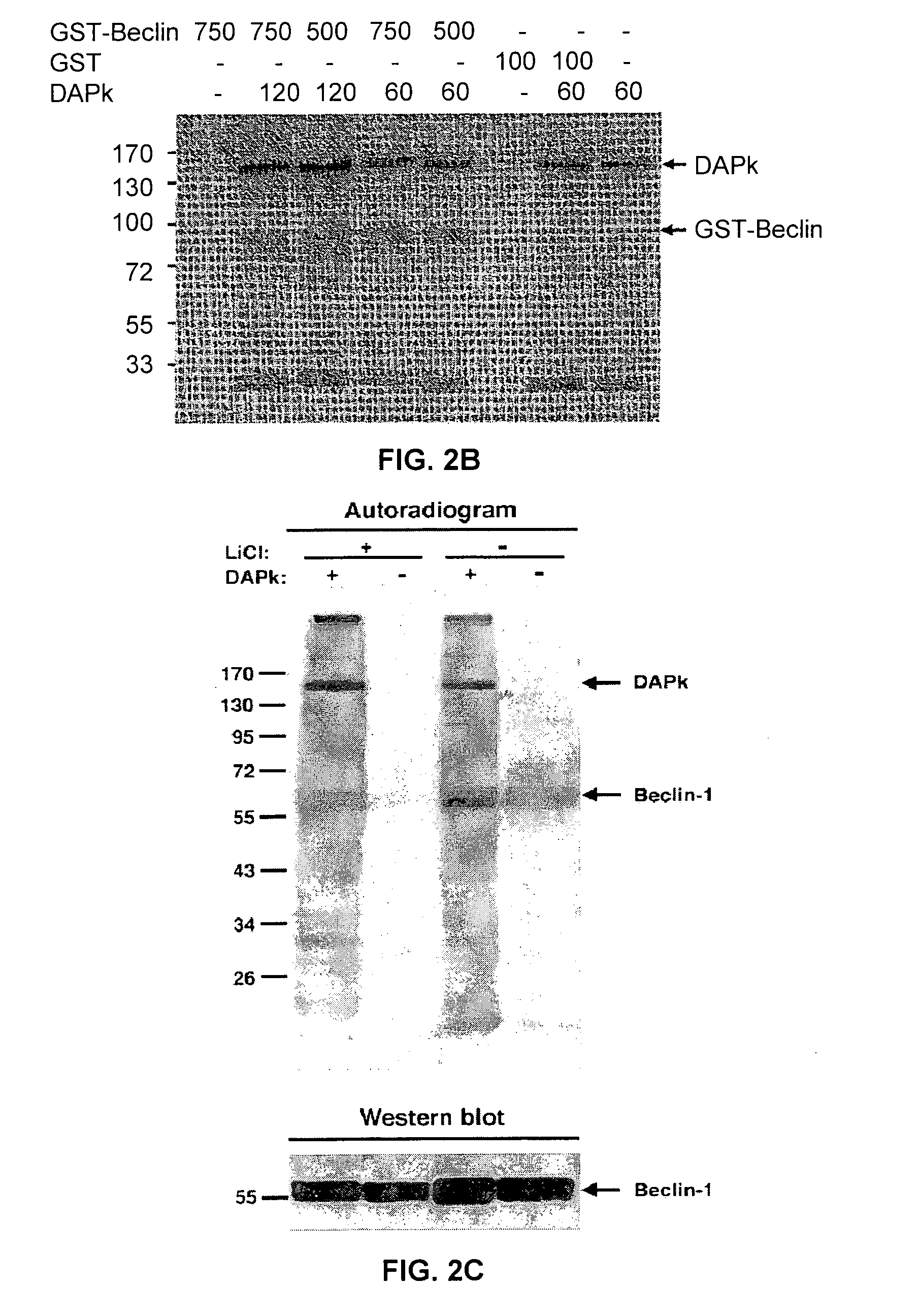 Compositions and methods for diagnosing and treating cancer and neurodegenerative diseases related to beclin-1