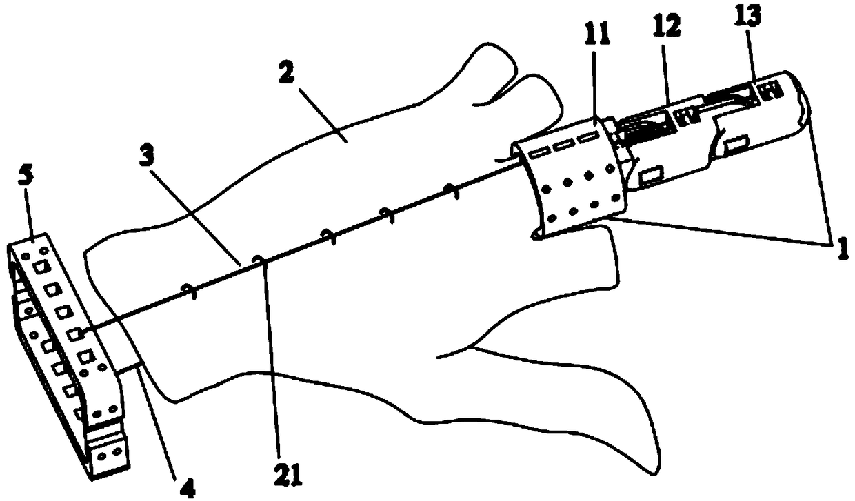 An underactuated prosthetic hand