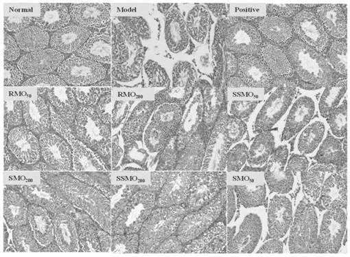 Radix morindae officinalis processed product oligosaccharide composition, and preparation method and application thereof