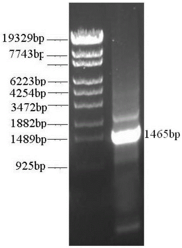 L-aspartase recombinant escherichia coli free of malic acid byproducts and construction method and application of L-aspartase recombinant escherichia coli