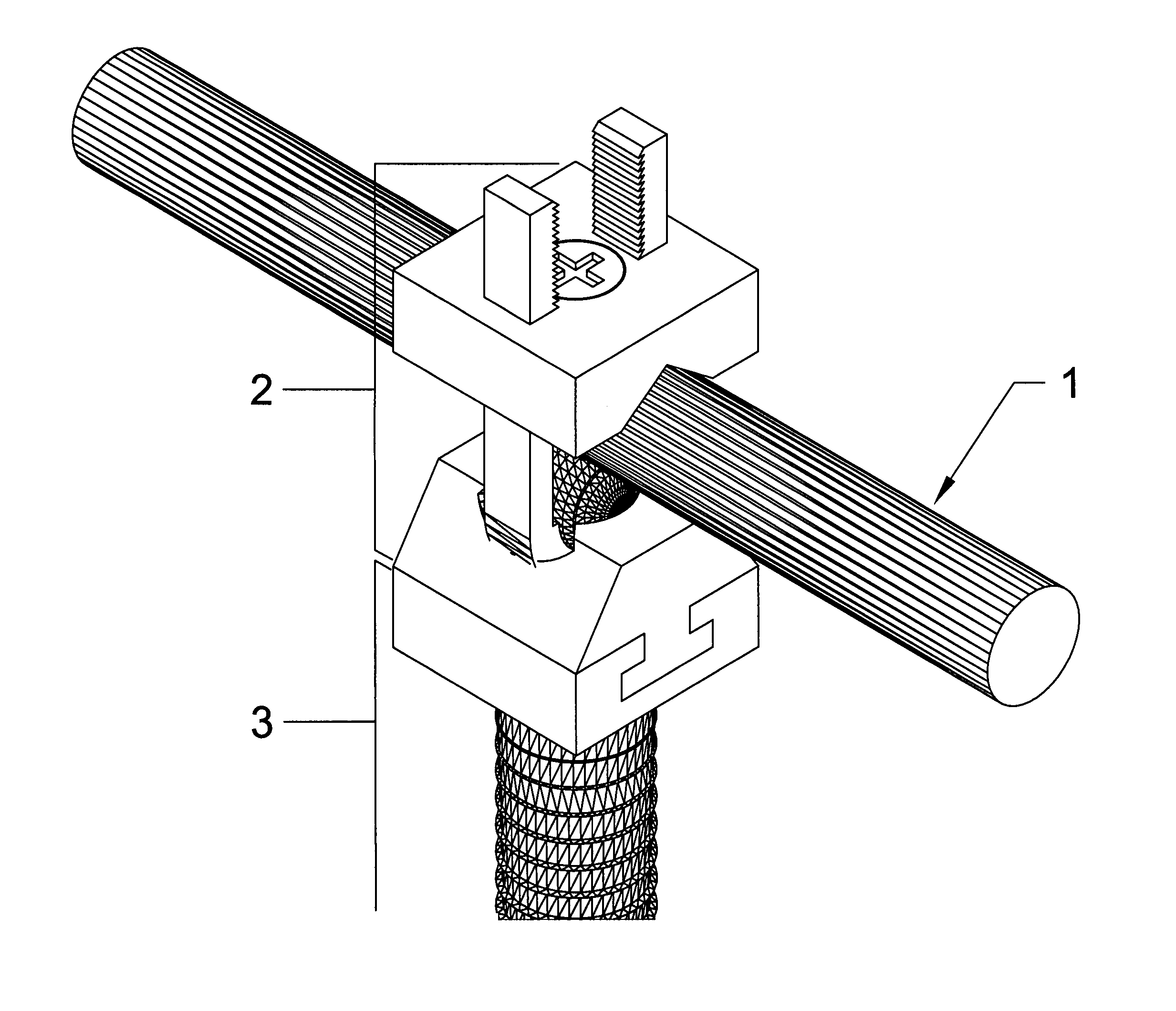 Tension fixation system