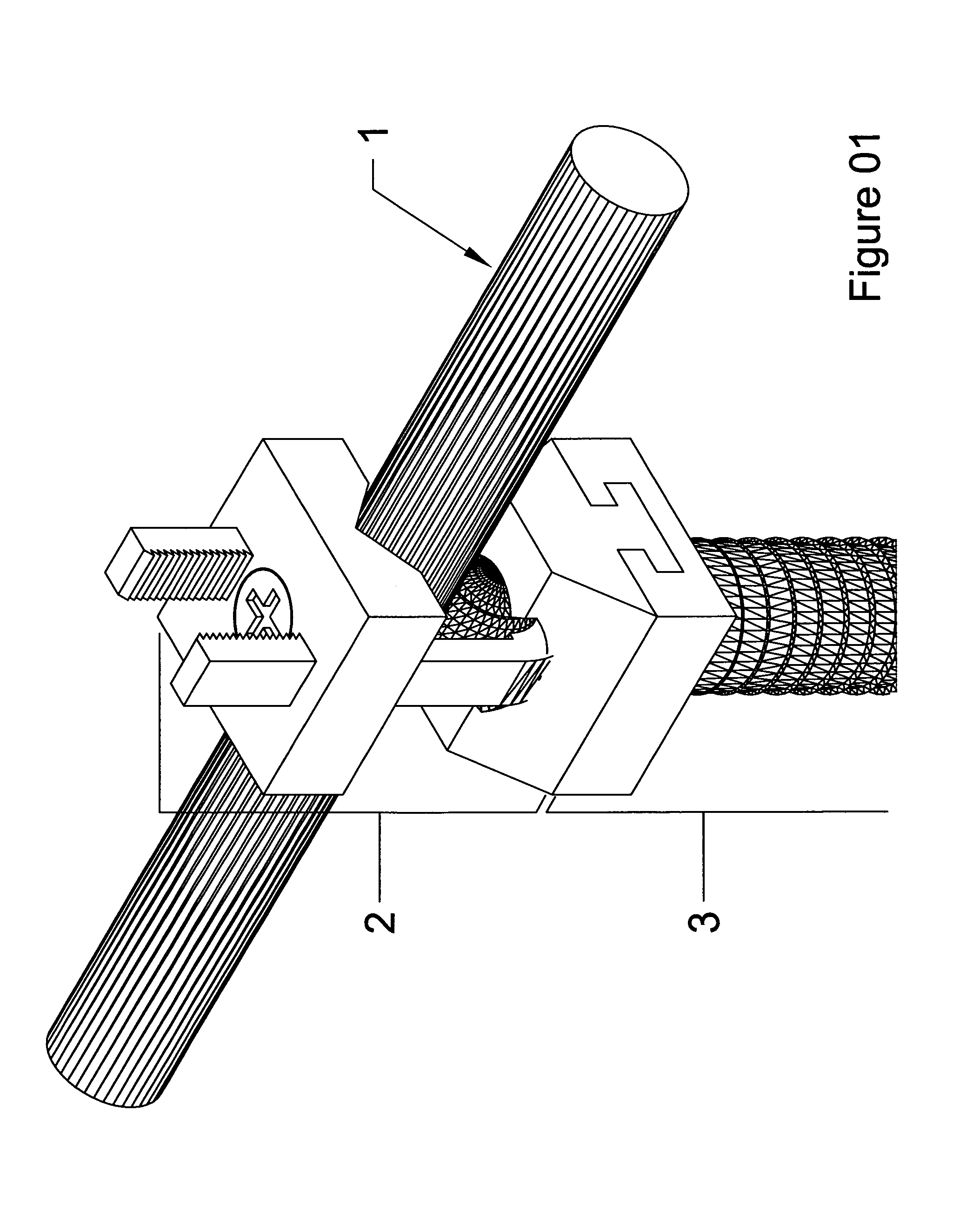 Tension fixation system