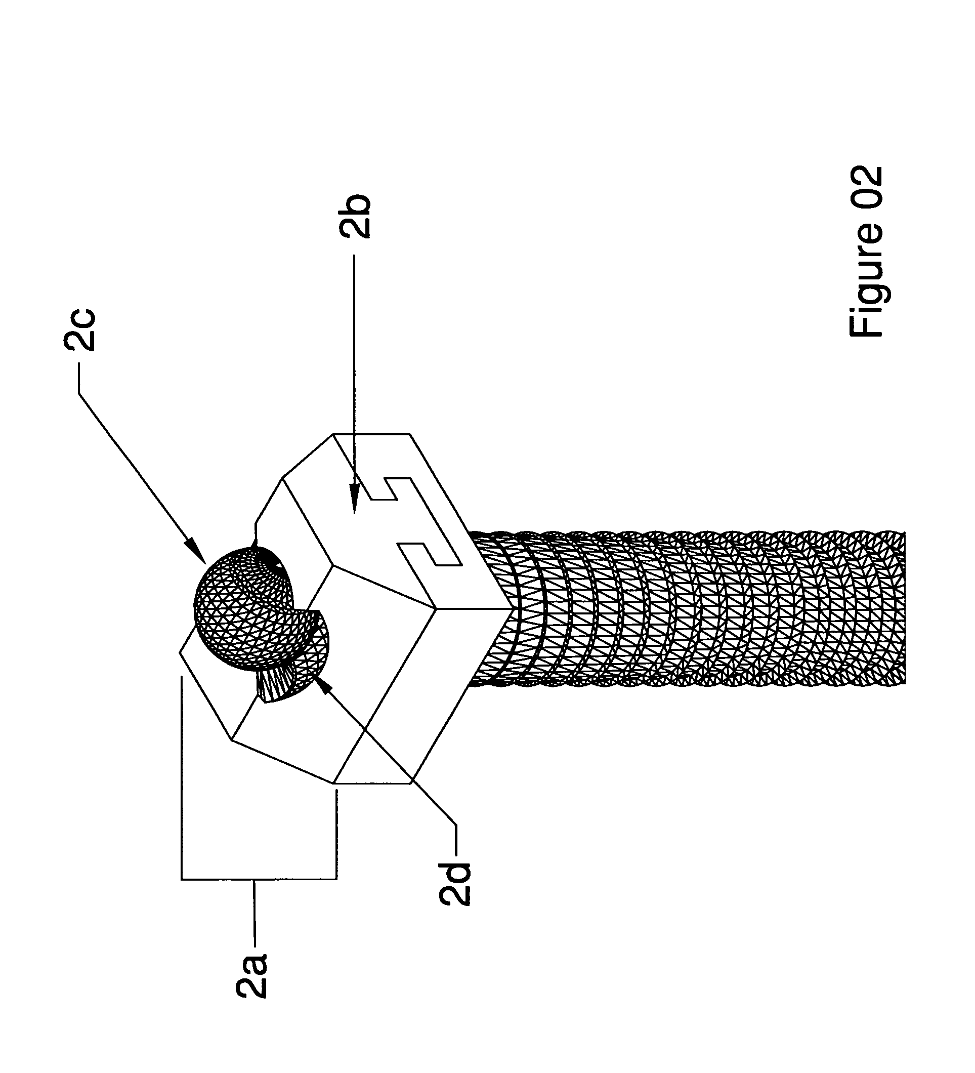 Tension fixation system