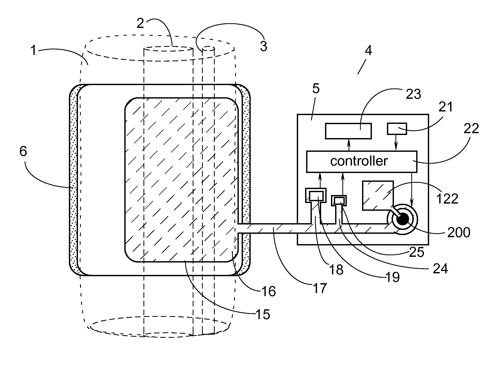 Arterial blood pressure monitor with a liquid filled cuff