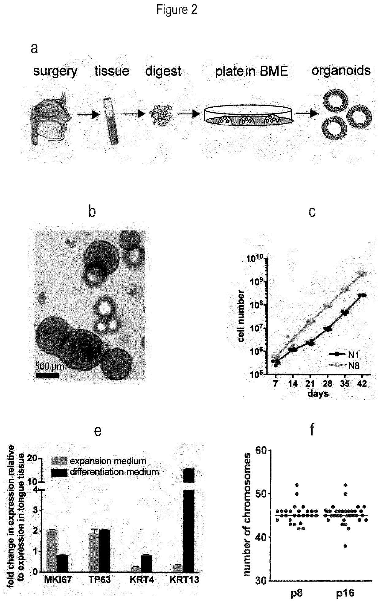 Culture Method for Head and Neck Organoids