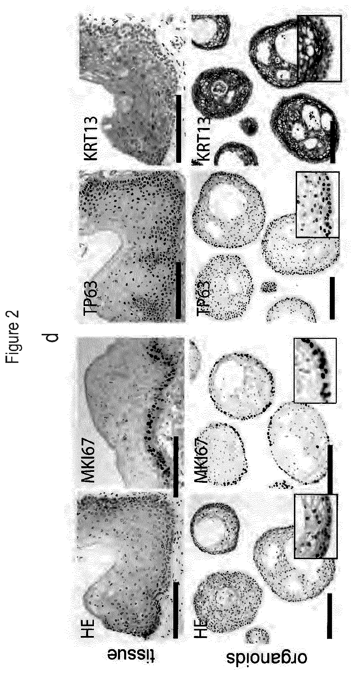 Culture Method for Head and Neck Organoids