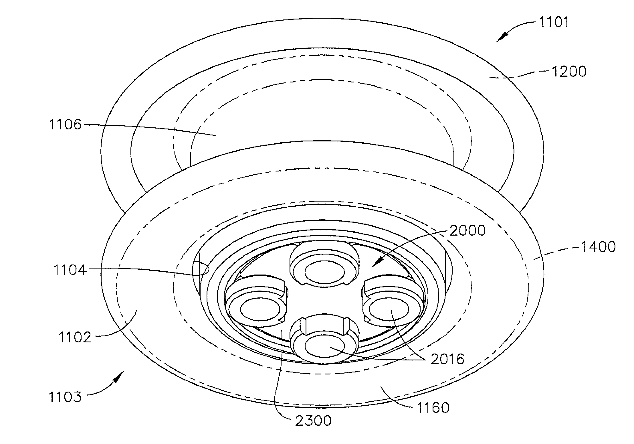 Method Of Surgical Access