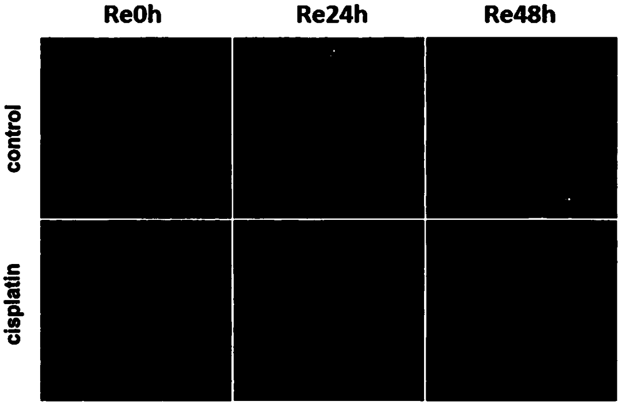 Atohla expression diagram method in zebra fish lateral line hair cell regeneration process