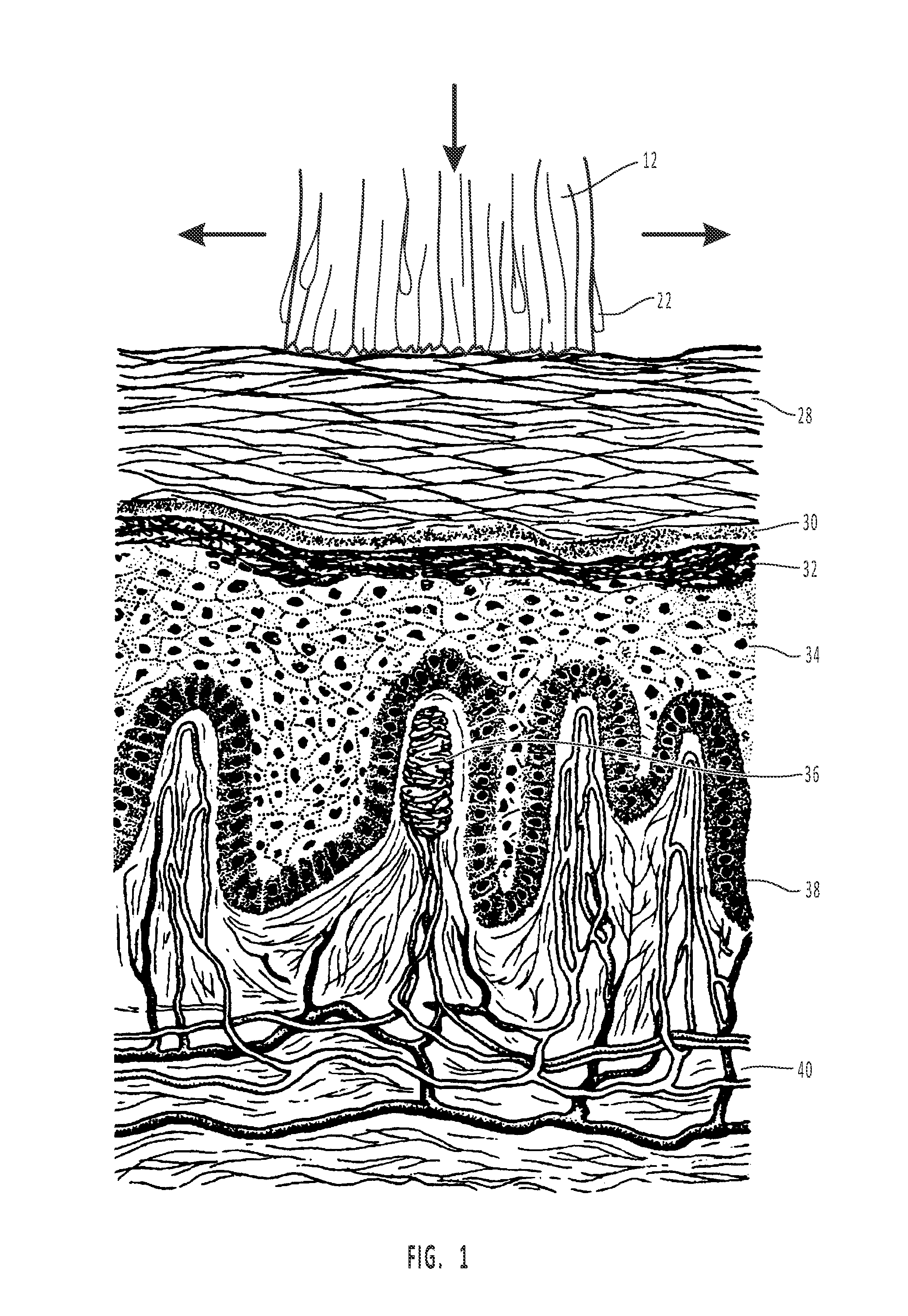 Highly penetrating compositions and methods for treating disordered tissues