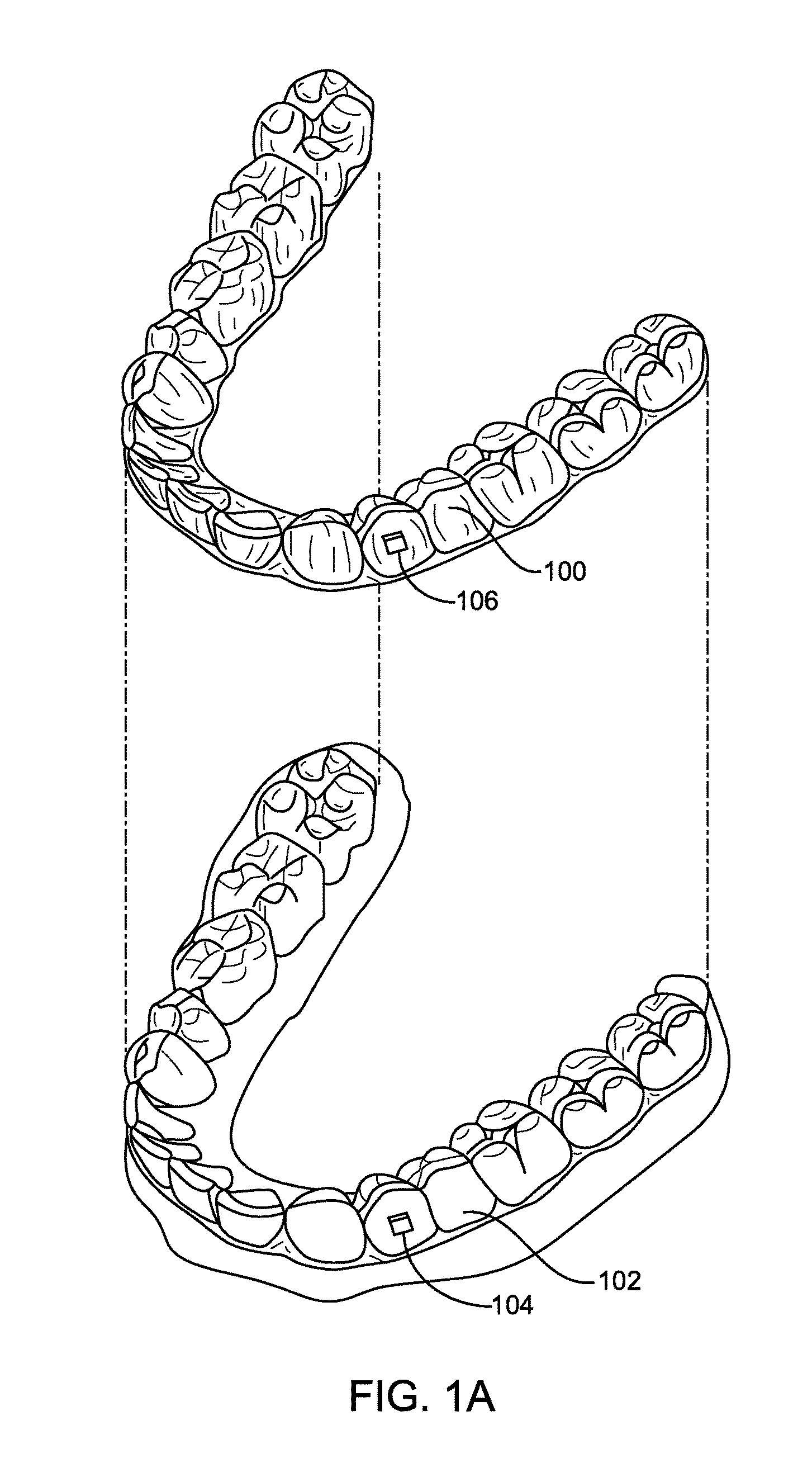 Direct fabrication of aligners for palate expansion and other applications