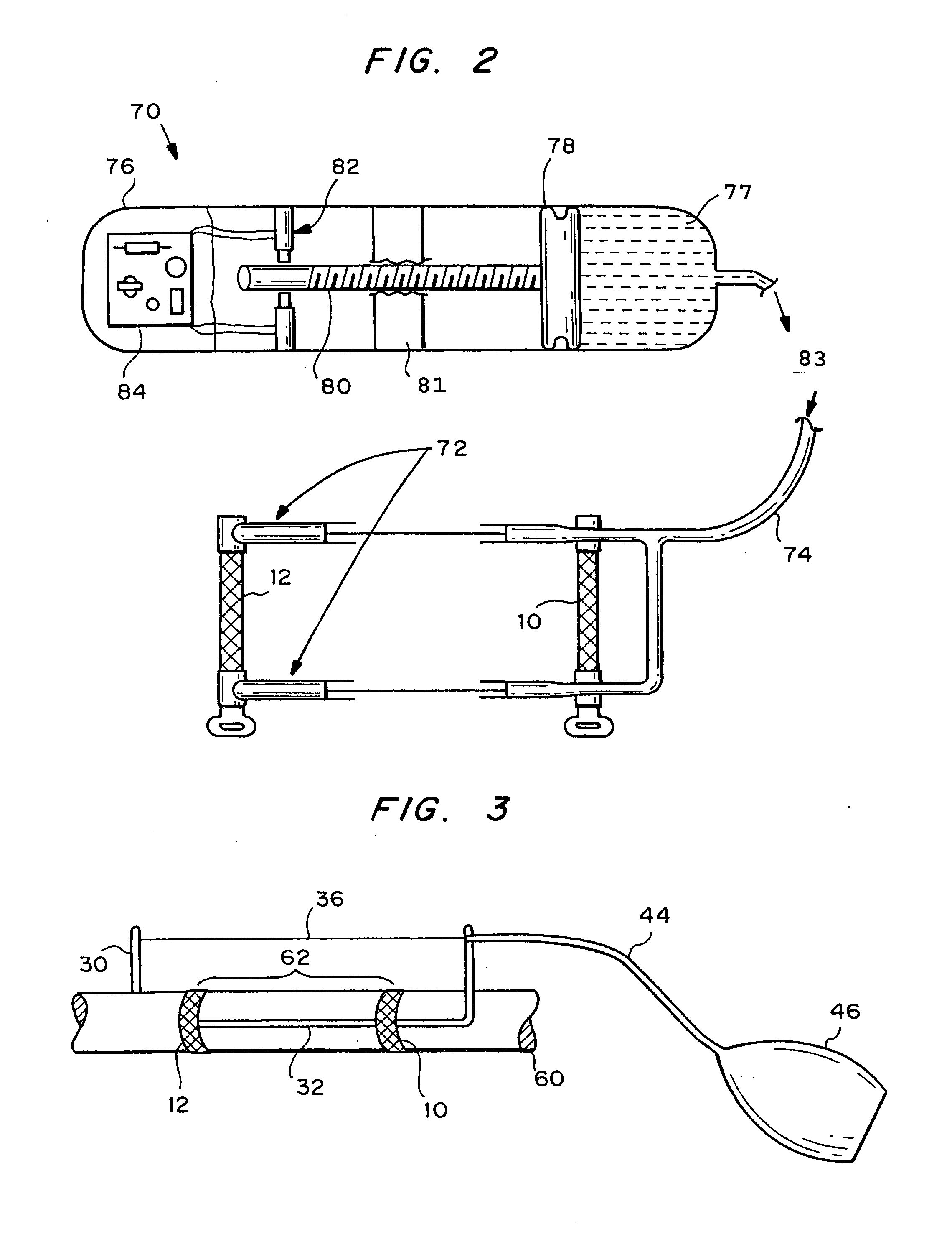 Device and method for creating a vascular graft in vitro