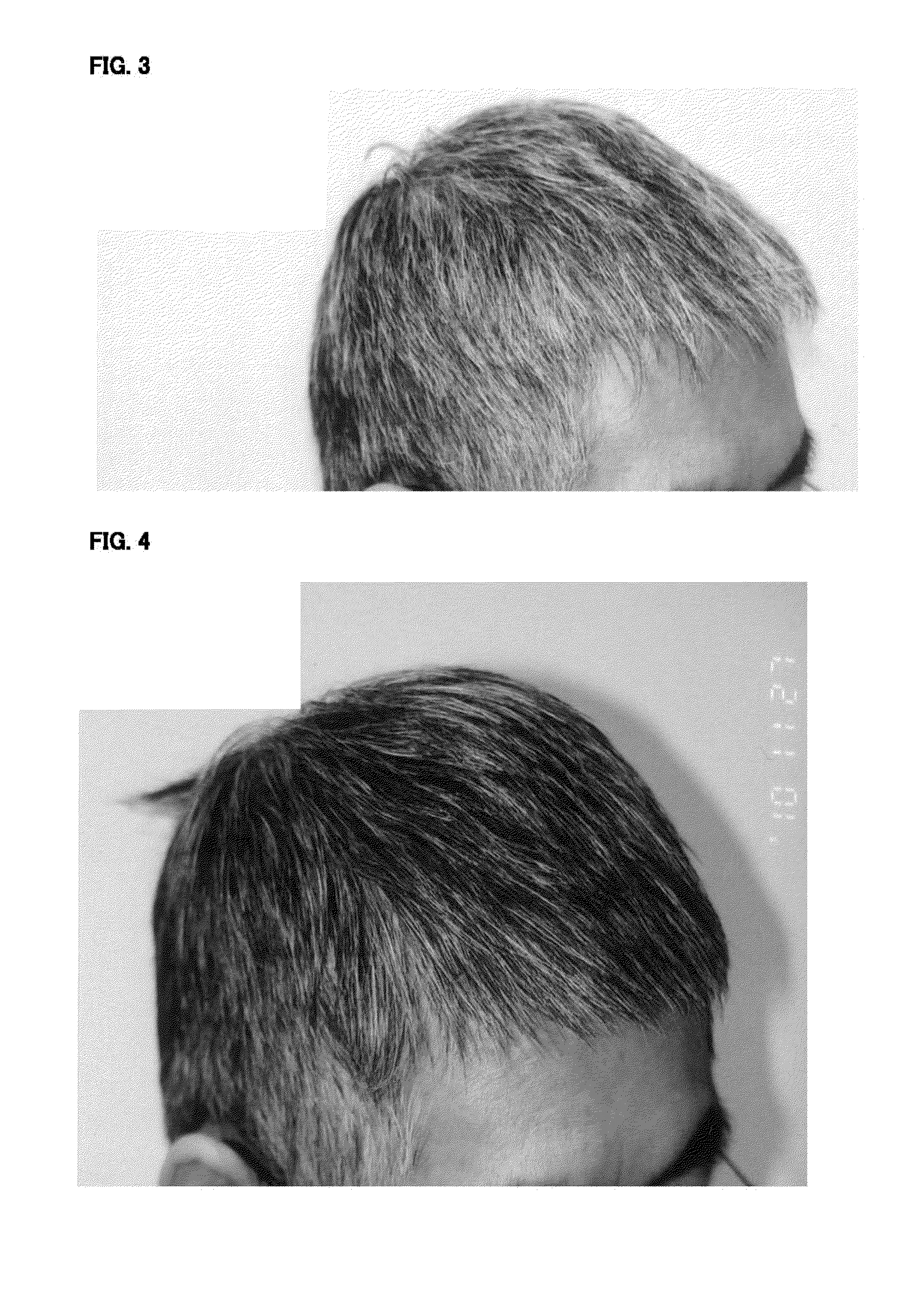 Hair growth and fostering agent