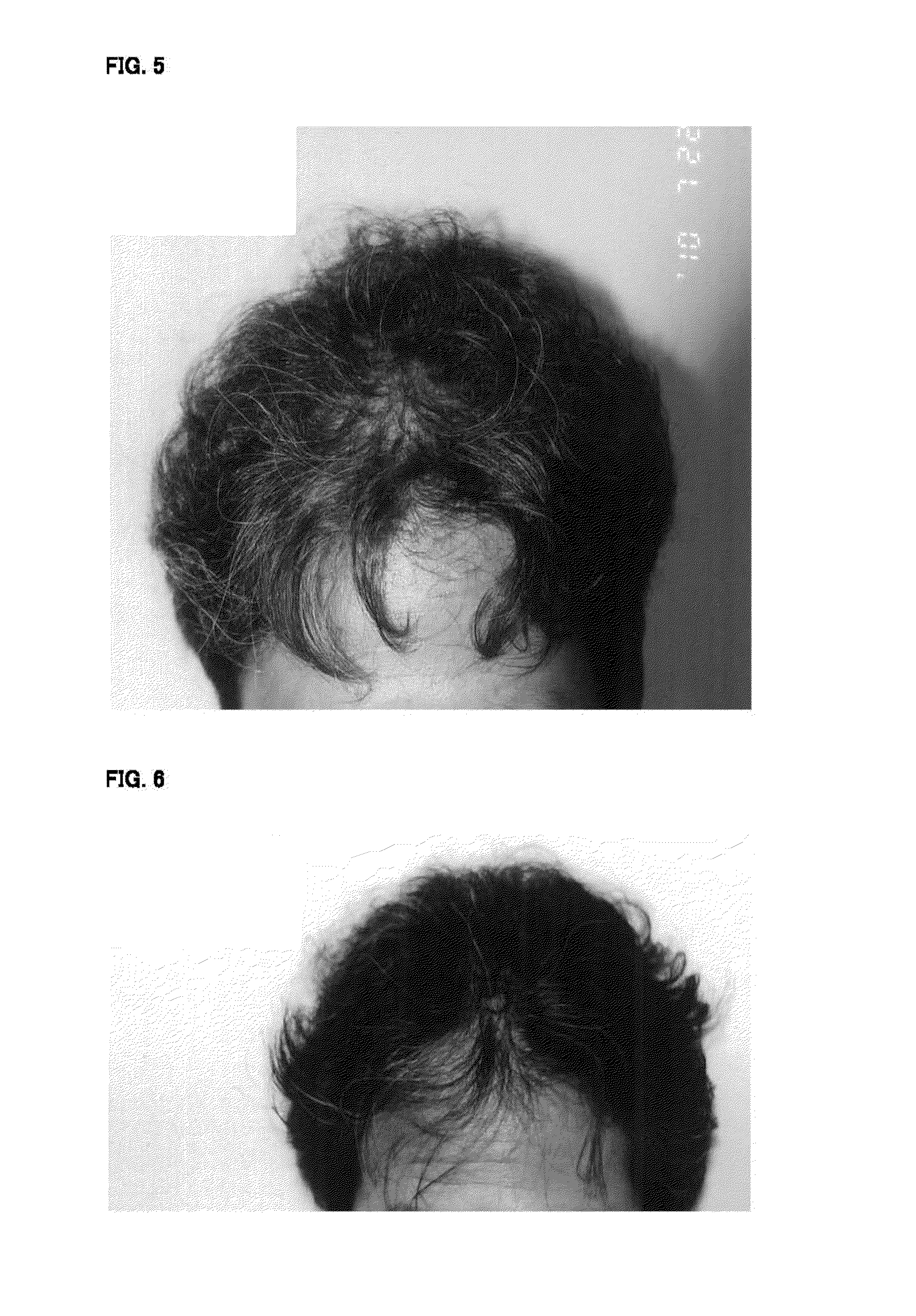 Hair growth and fostering agent