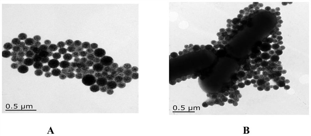 A detection method of Lactobacillus rhamnosus immunomagnetic bead electrochemical sensor