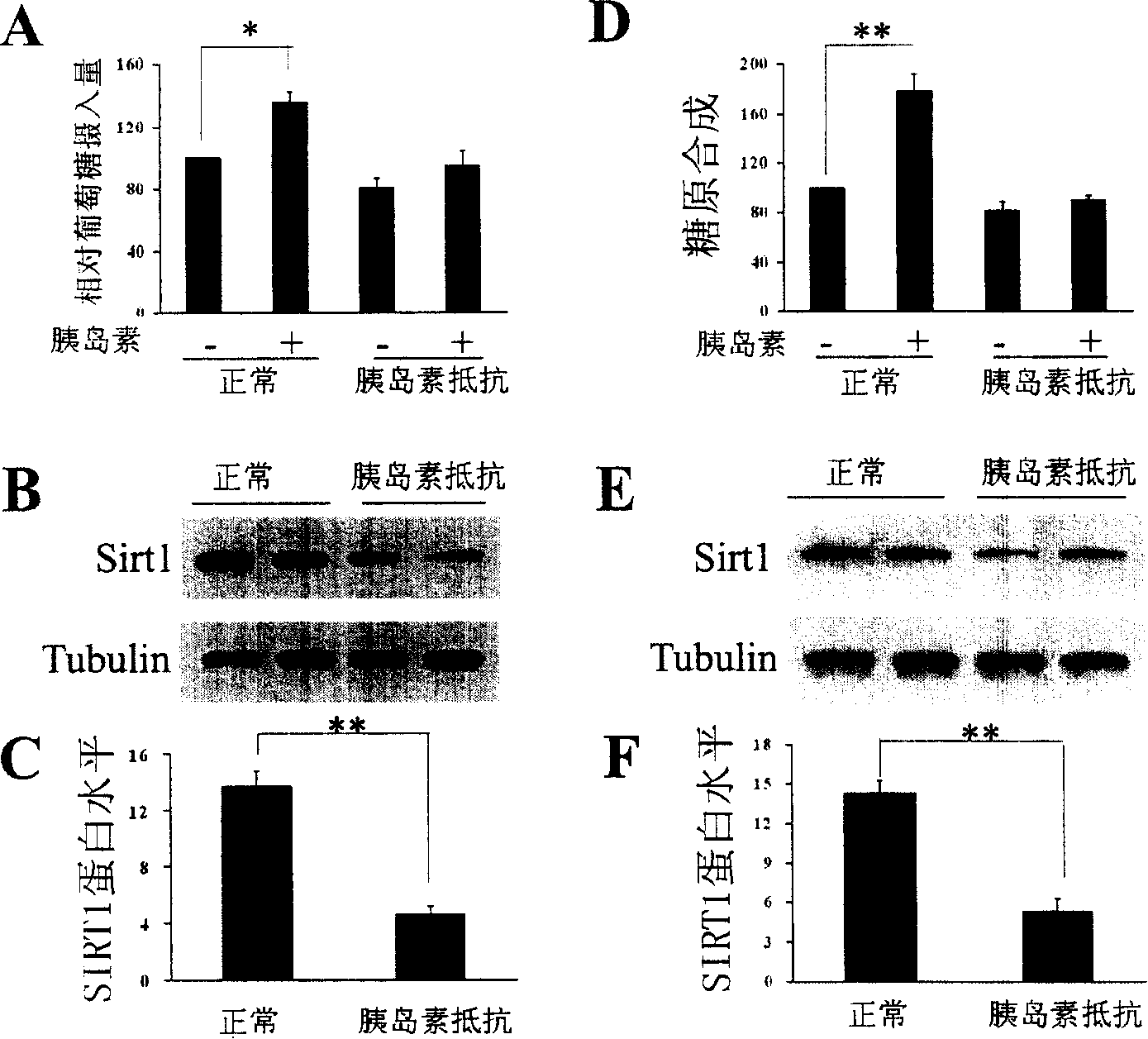 Method and composition for increasing insulin sensibility