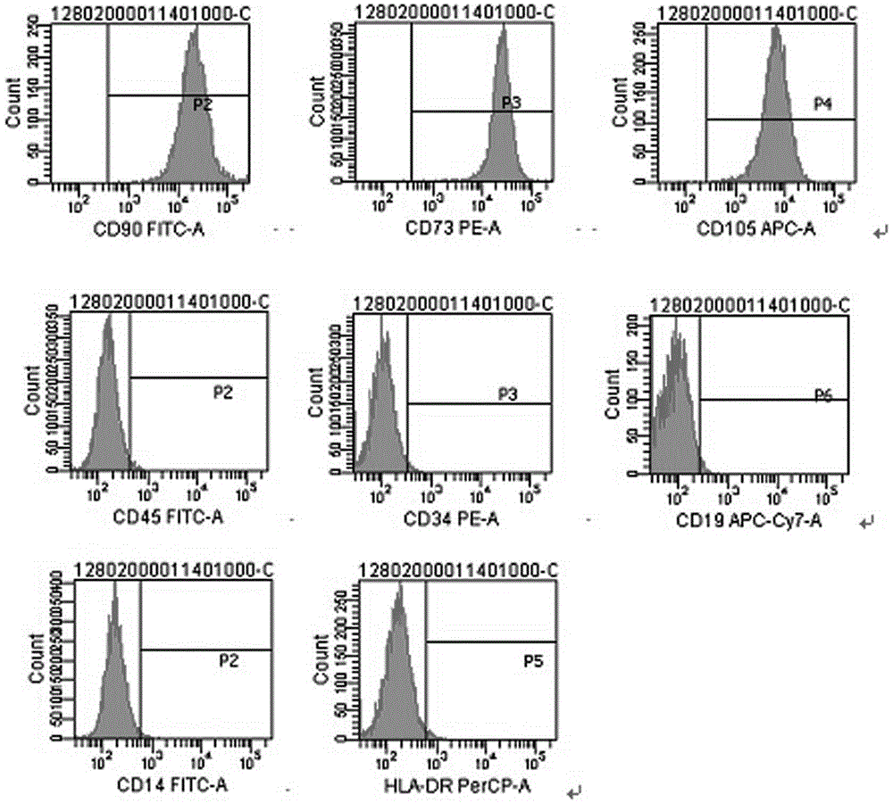 Stem cell-based medicinal product for treating diabetes and preparing method thereof