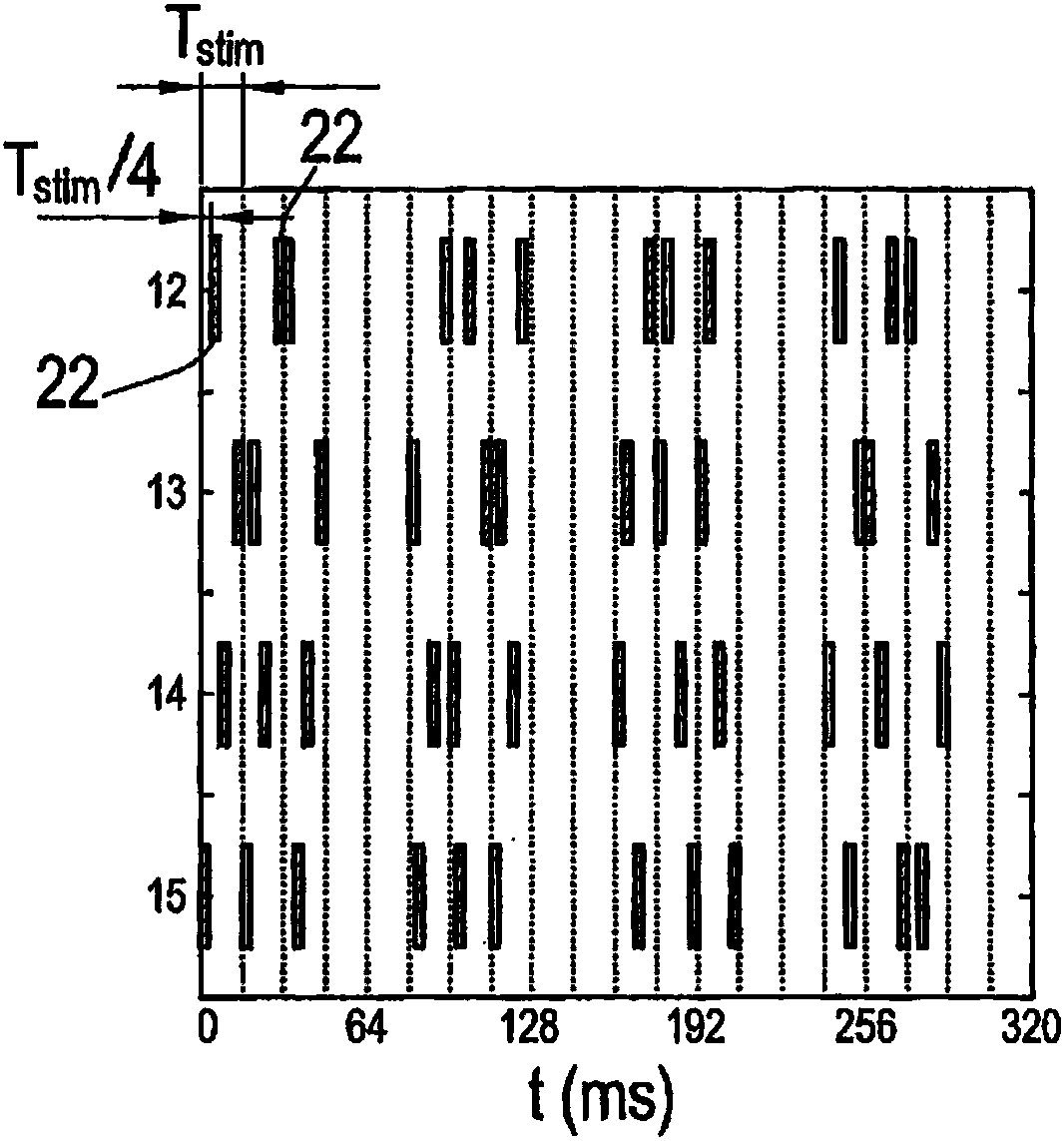 Device and method for effective invasive two-stage neurostimulation