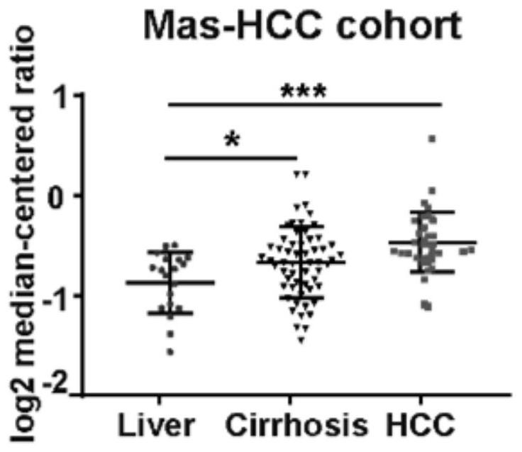 Application of INPP5F in preparation of medicine for prognosis, diagnosis or prevention and treatment of liver cancer tissue tumors