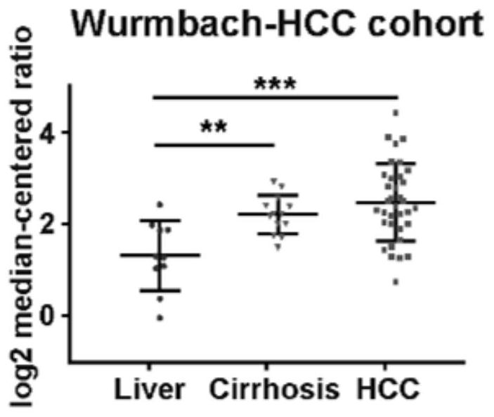 Application of INPP5F in preparation of medicine for prognosis, diagnosis or prevention and treatment of liver cancer tissue tumors