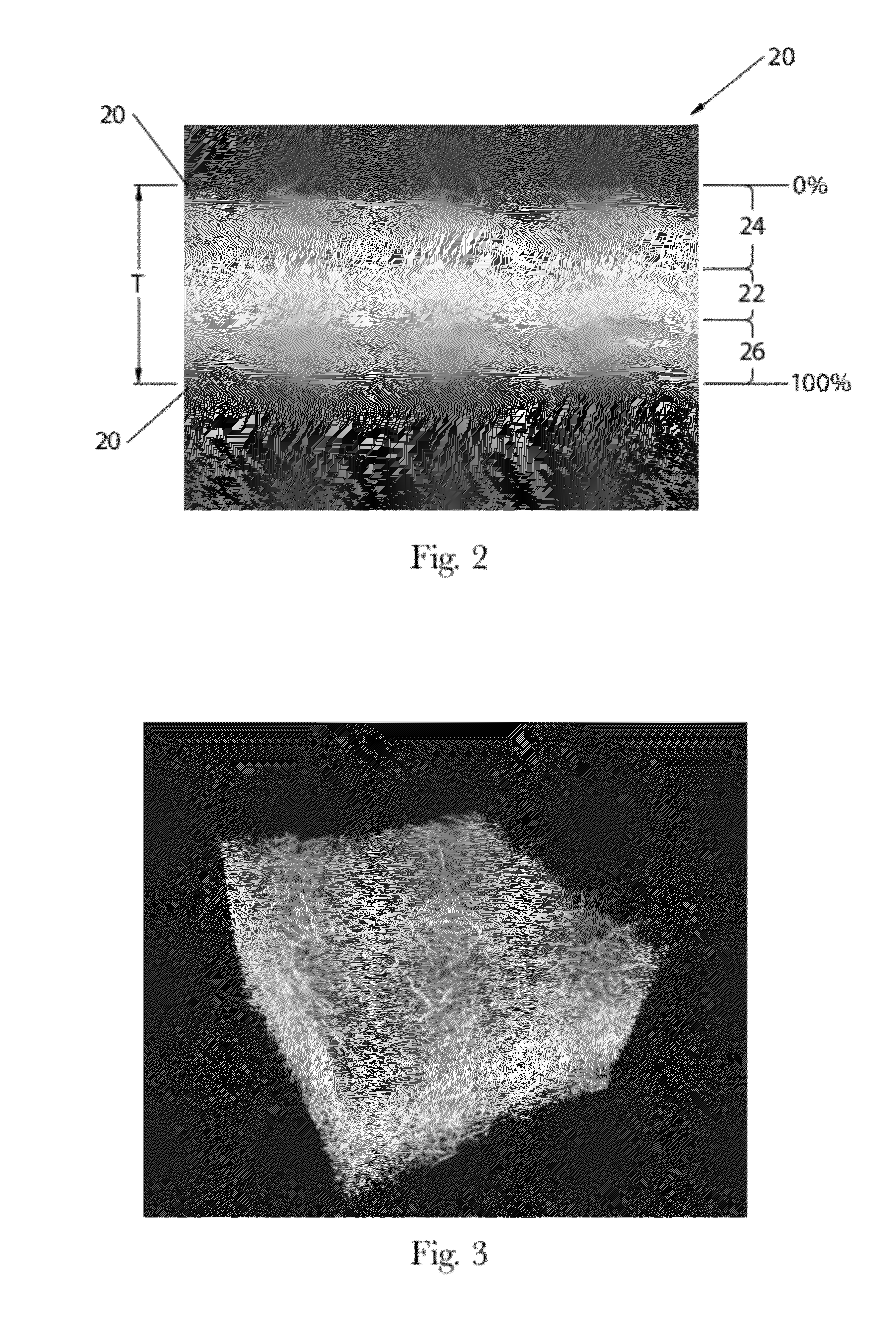 Absorbent Members Having Skewed Density Profile