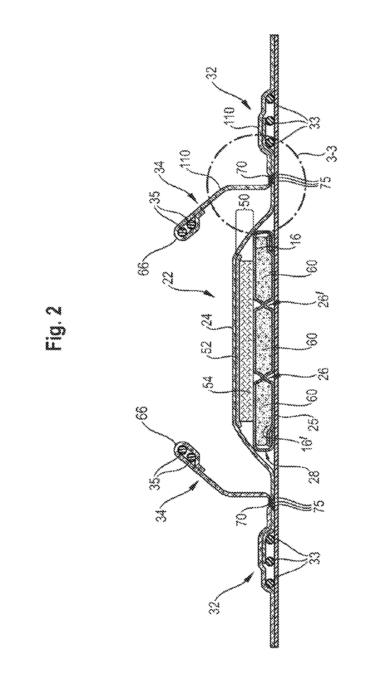 Absorbent articles with barrier leg cuffs