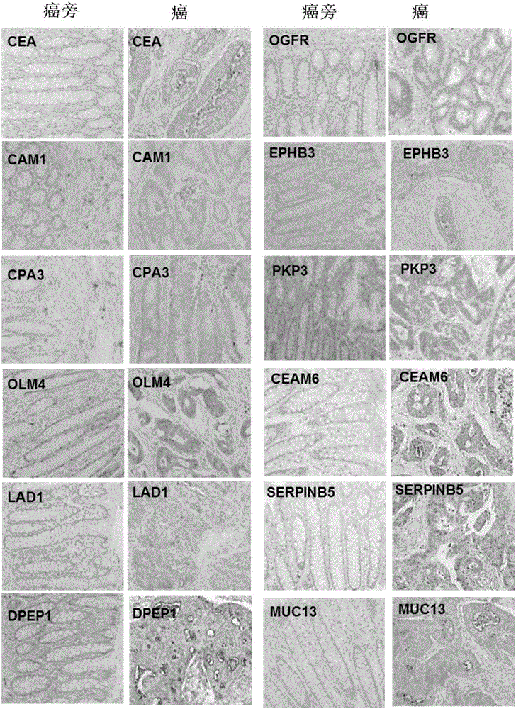 Use of set of biomarkers in preparation of colorectal cancer diagnostic reagents