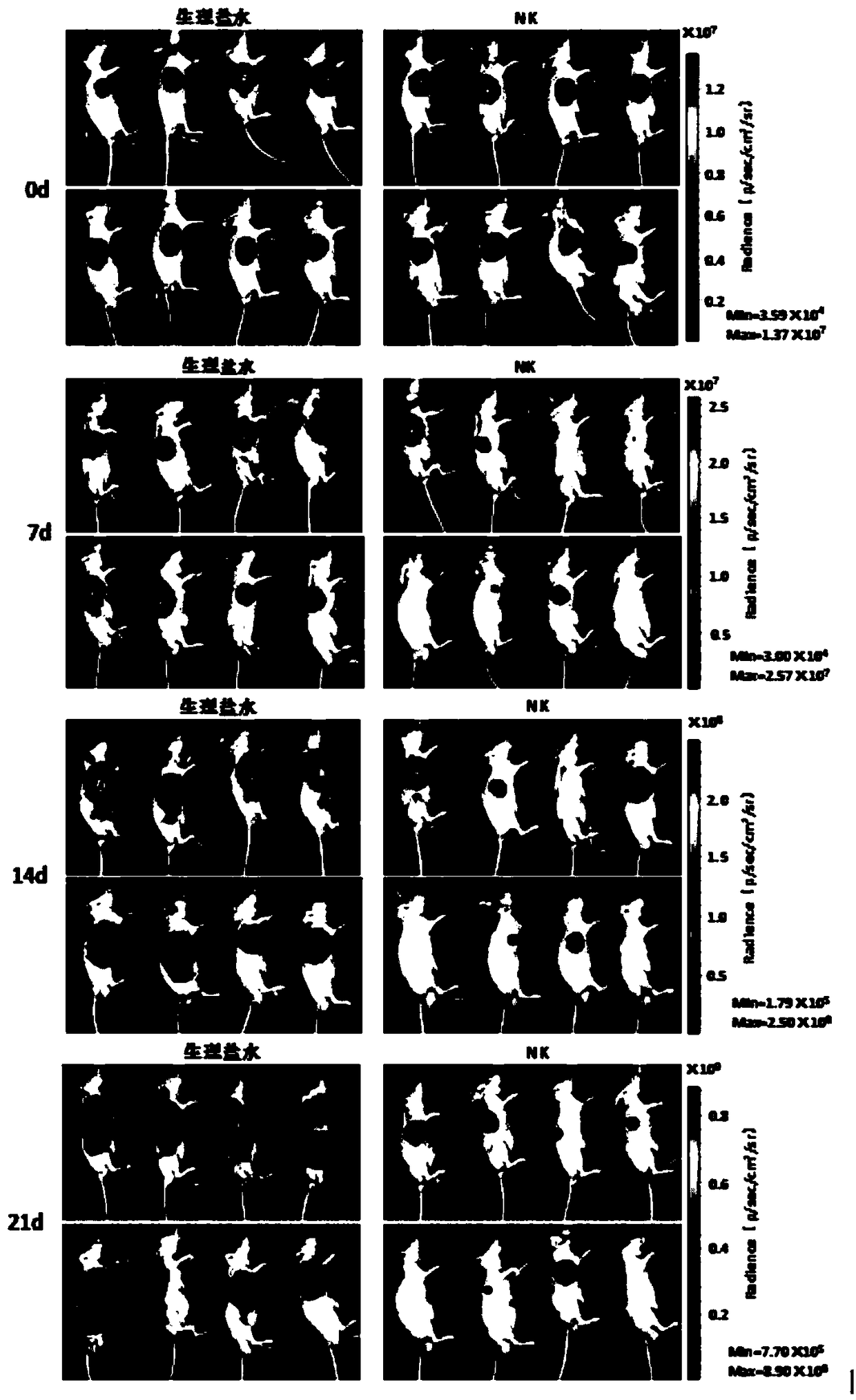 Experiment method for preventing melanoma through nature killer (NK) cells