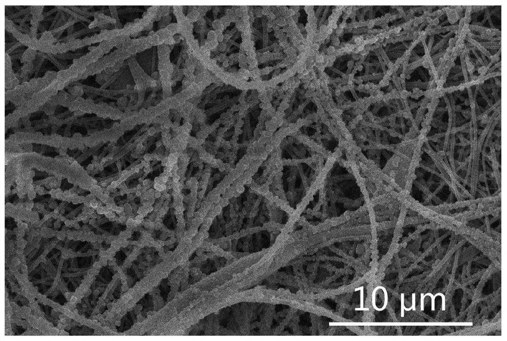 A mofs-modified double-layer structure composite electrospun nanofiber membrane and its preparation method and its application in blood purification