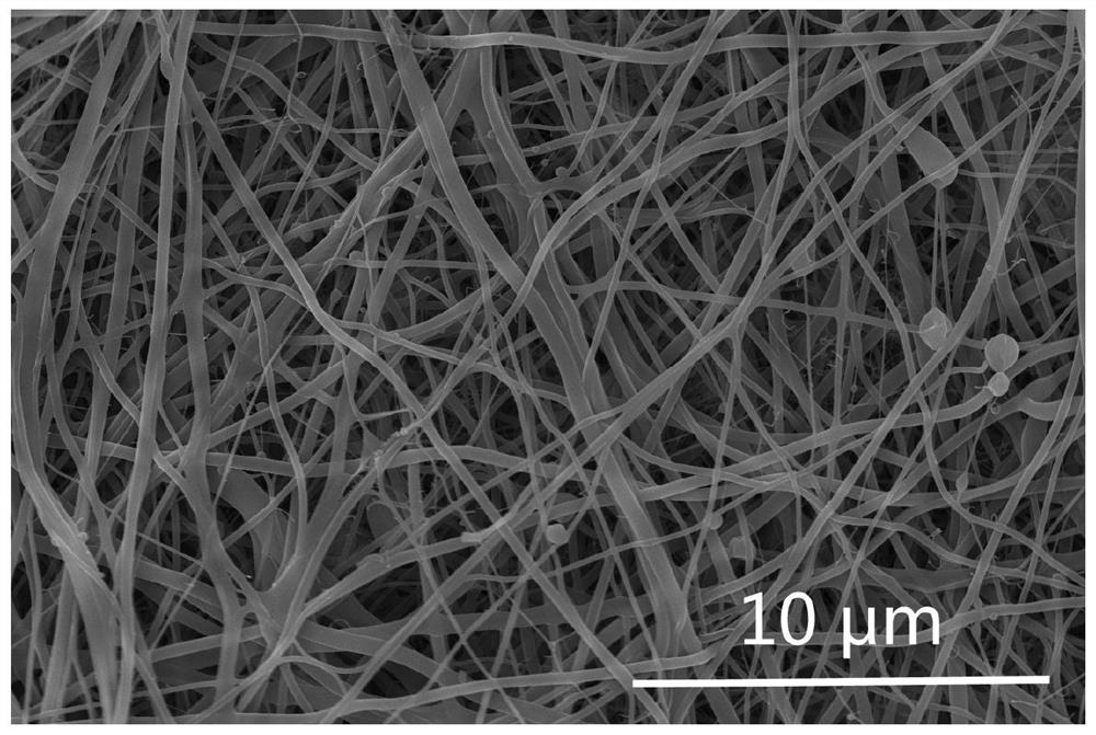 A mofs-modified double-layer structure composite electrospun nanofiber membrane and its preparation method and its application in blood purification