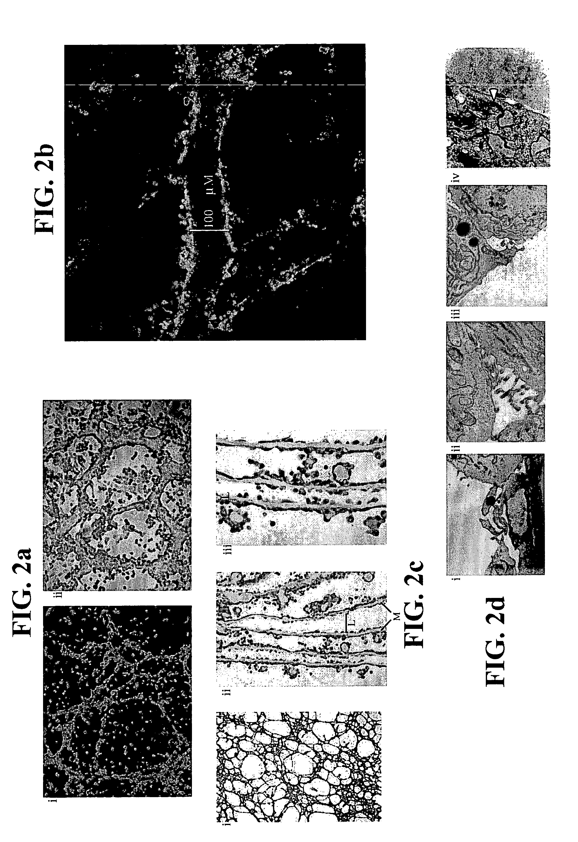 Hemangioblast progenitor cells