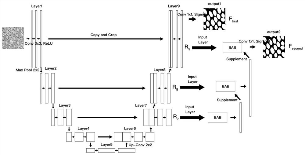 Medical image segmentation method and system based on AS-UNet