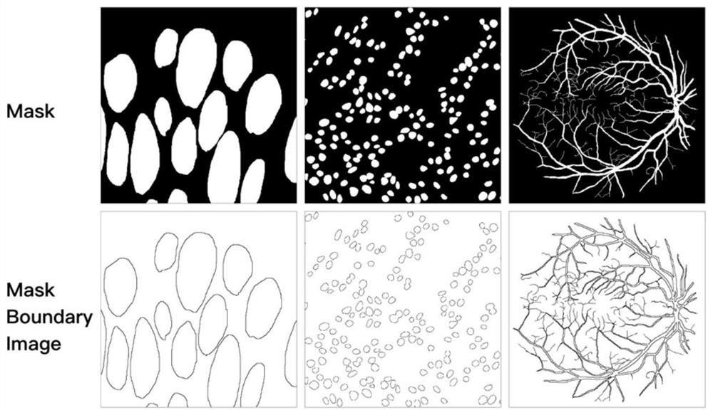 Medical image segmentation method and system based on AS-UNet