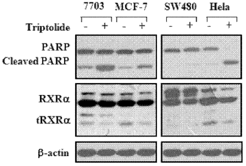 Application of triptolide, triptolide derivant and triptolide analogue in preparation of antitumor drugs